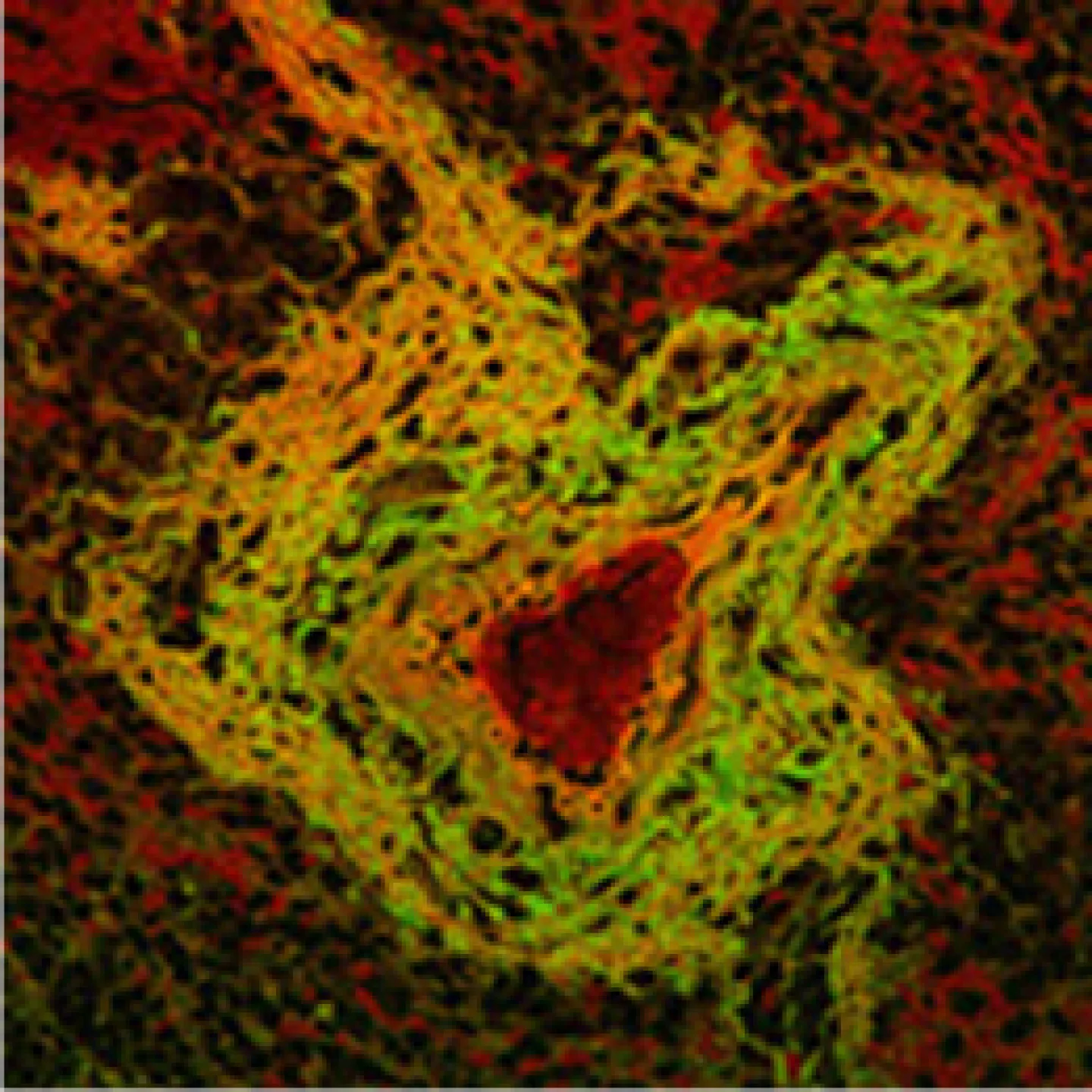 Dina_artery thumb