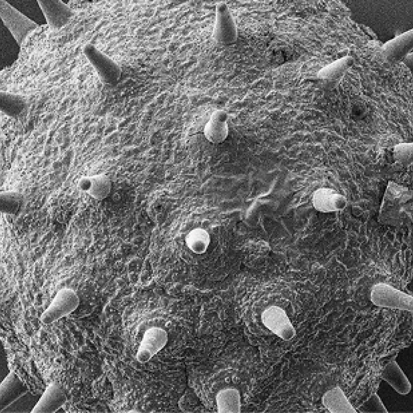 Electron_Microscopy_Image