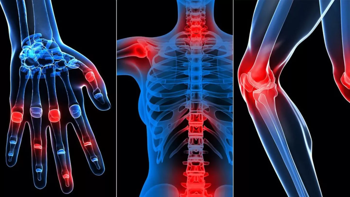 division-of-rheumatology