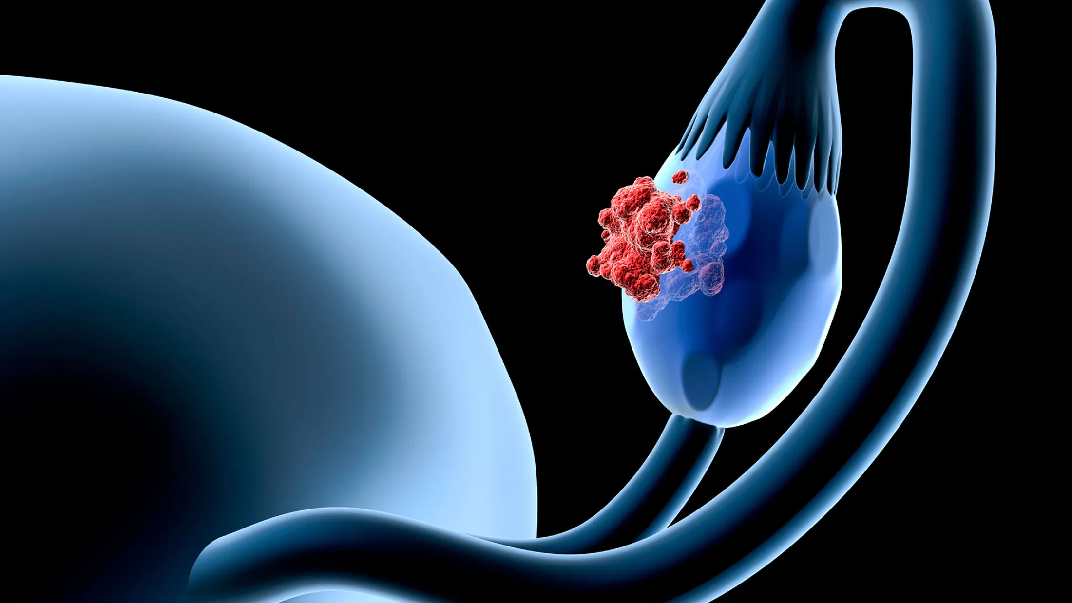 Robbing Cancer Cells of Drug Resistance