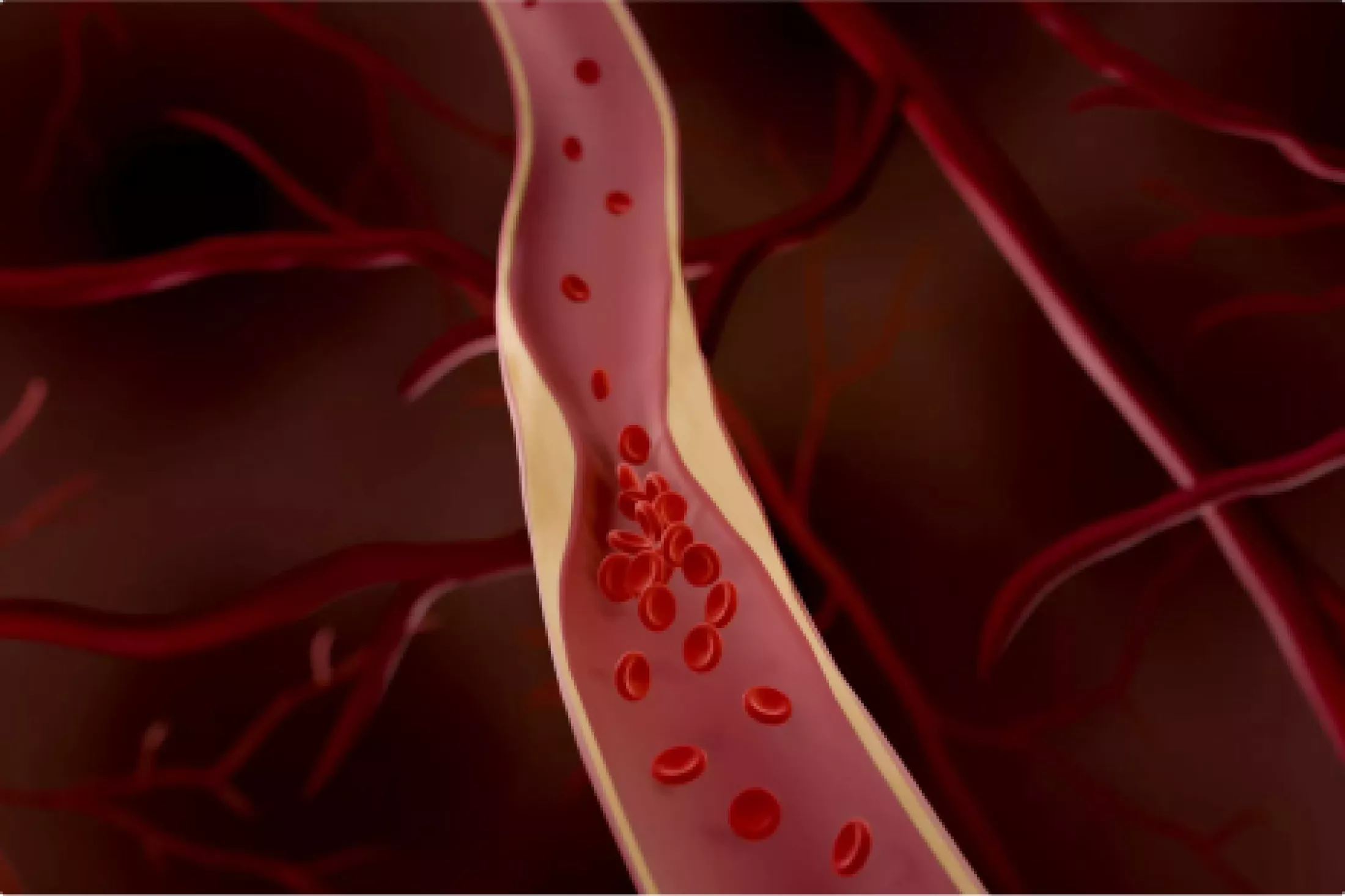 Possible Strategy for Preventing Artery Narrowing