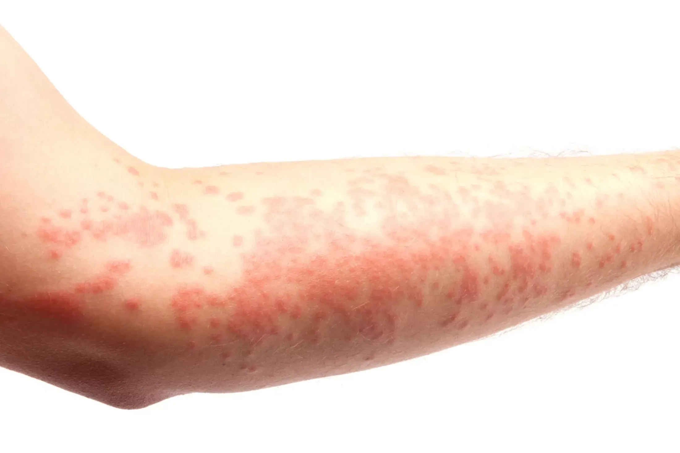 Dermatology News