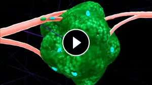 Live breast tumor imaging