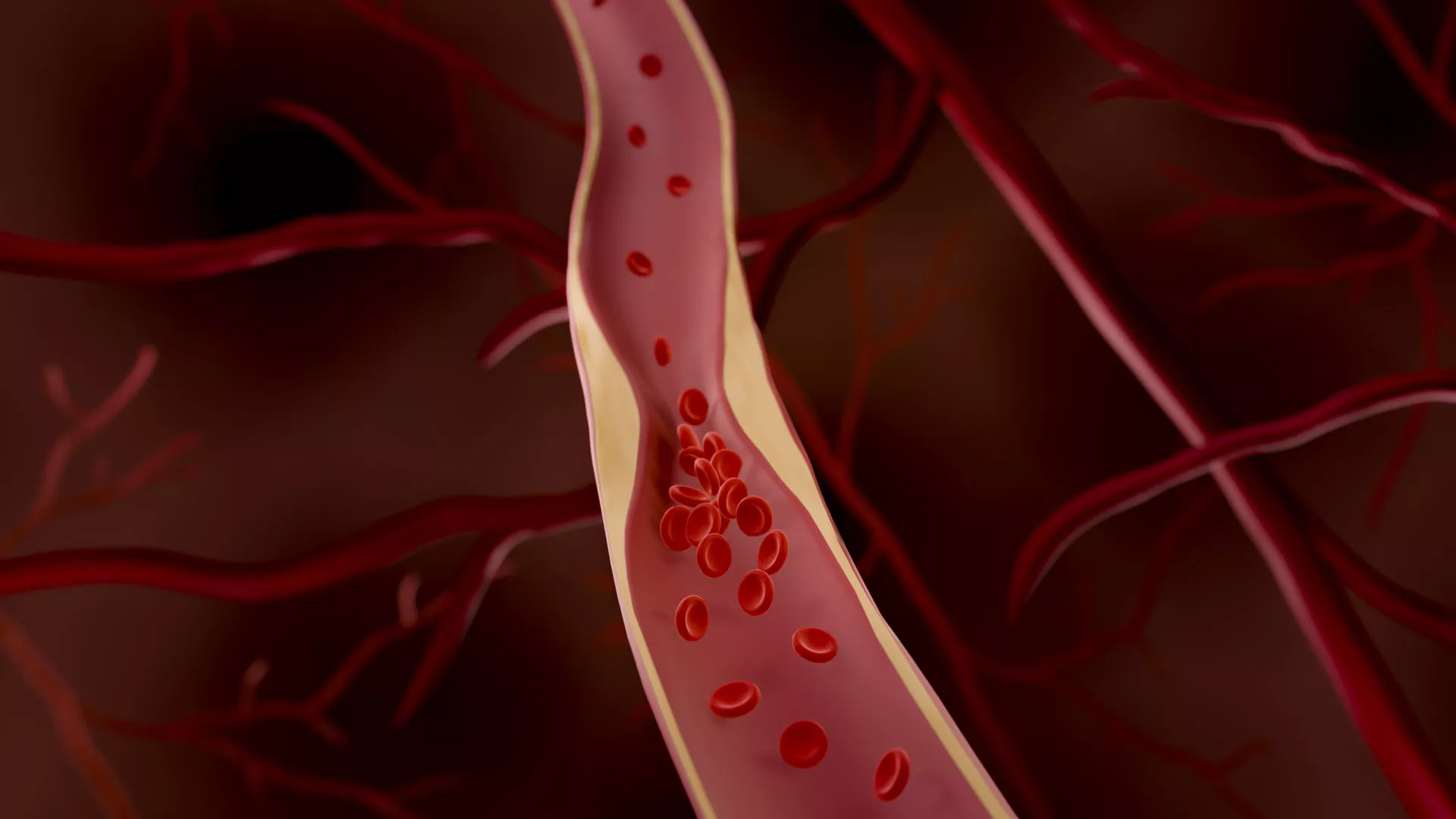 https://montefioreeinstein.org/news/2024/03/19/possible-strategy-preventing-artery-narrowing