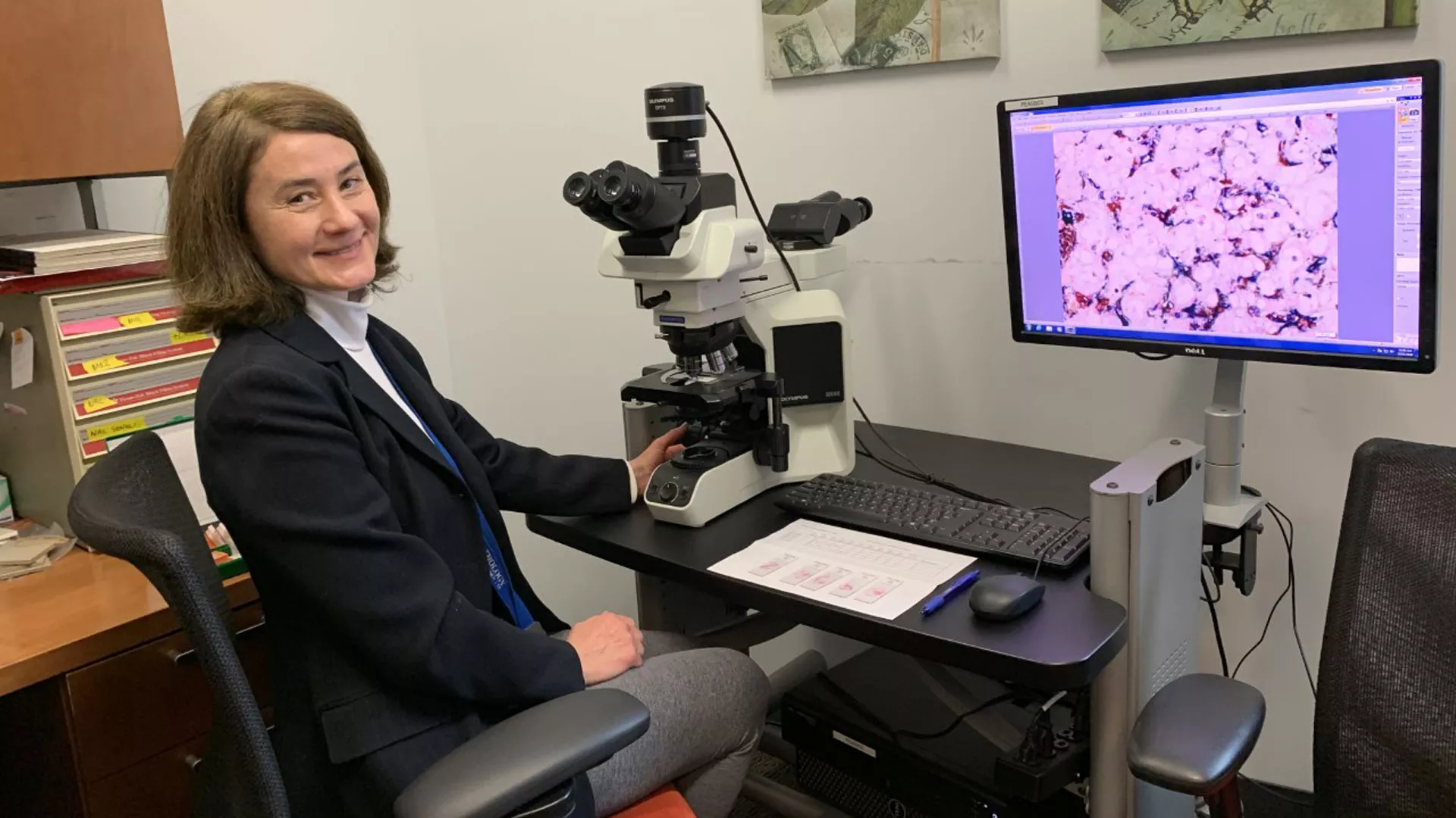 Unraveling the Mysteries of Metastasis