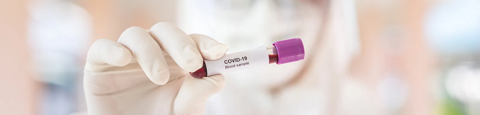 Research Areas Billboard Image Lab Scientist Covid19