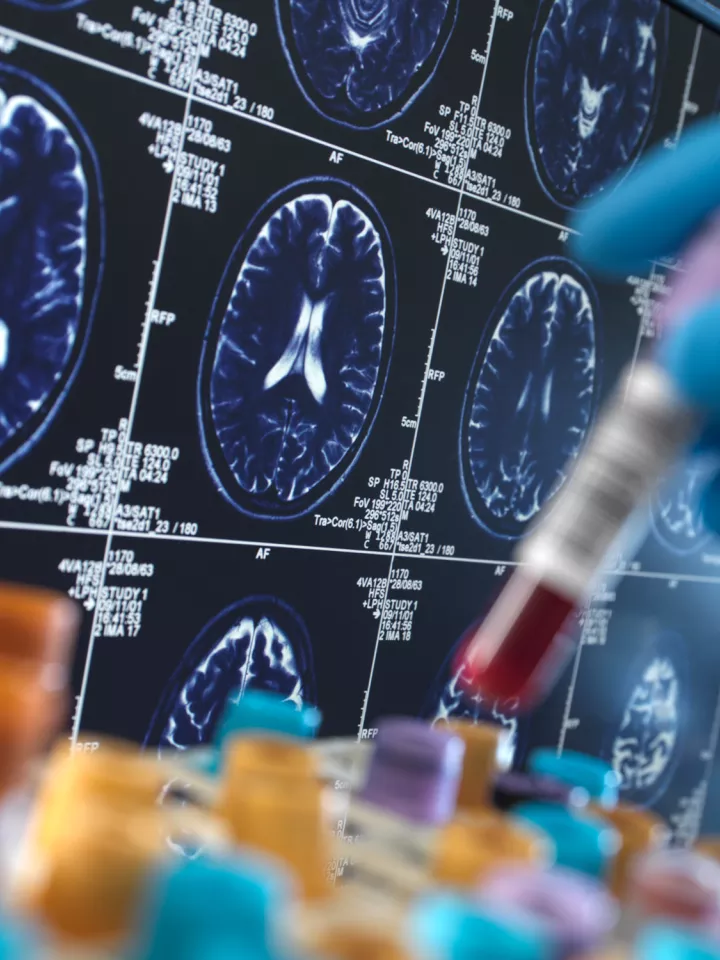 clinical-research