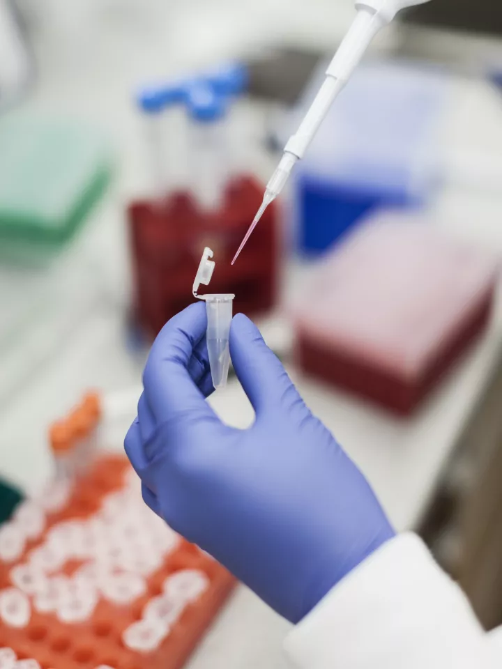 Lab Pipetting