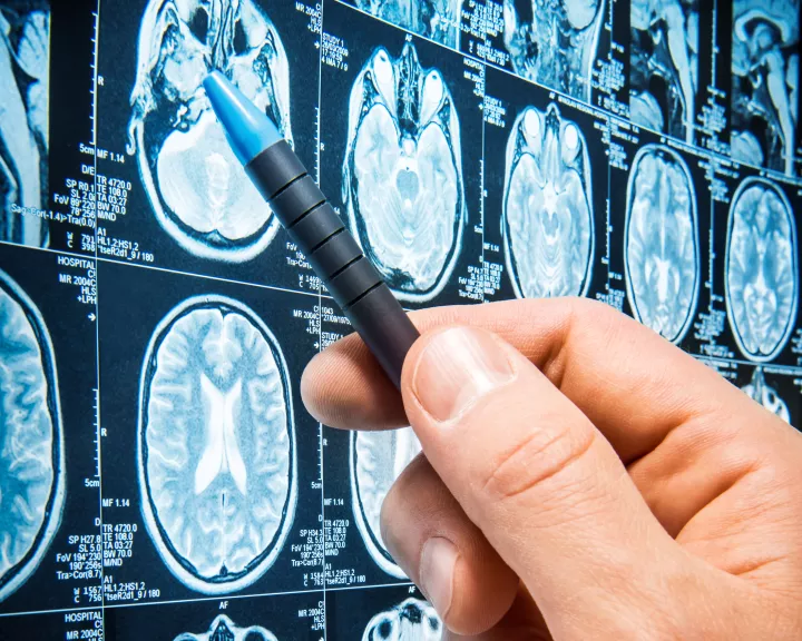 PBS GettyImages-research