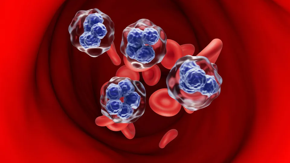 Promising Cell Therapy for Relapsed Refractory T-Cell Lymphomas