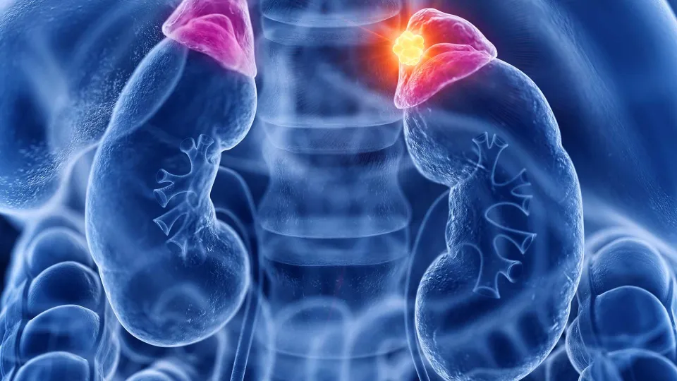 The Challenge of Diagnosing Rare Disease Using Genomic Databases