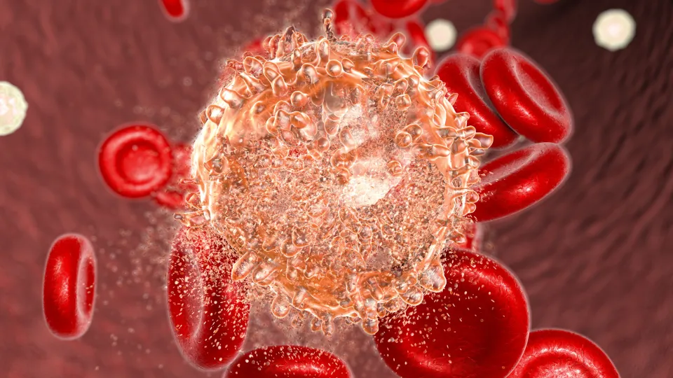 Destruction of Leukaemia Blook Cell