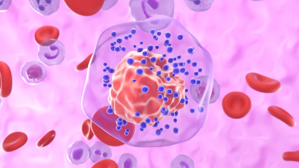 Finding the Molecular Causes of an Aggressive Form of Breast Cancer