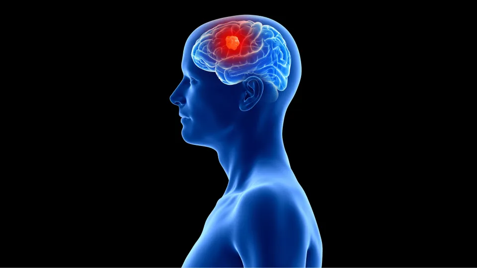 Illustration of a brain